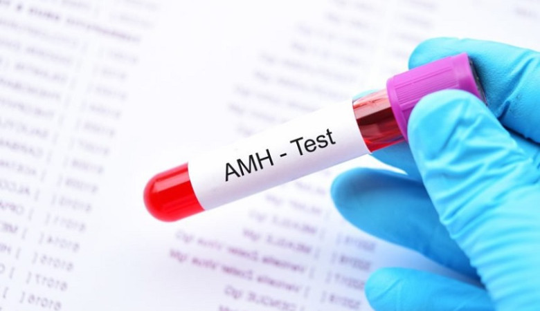 Xét nghiệm AMH – Đánh giá khả năng dự trữ buồng trứng
