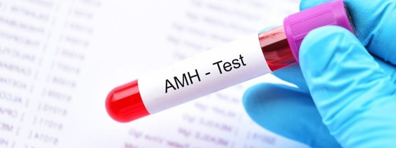 Xét nghiệm AMH – Đánh giá khả năng dự trữ buồng trứng