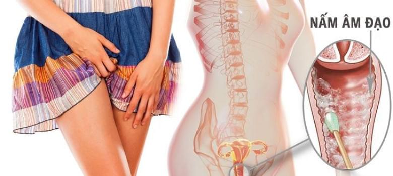 Soi dịch tươi âm đạo Soi tươi dịch âm đạo là gì