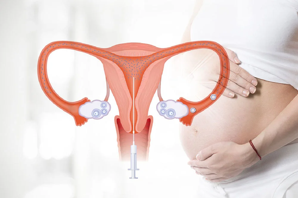 5+ phương pháp điều trị vô sinh hiếm muộn phổ biến hiện nay 3 5+ phương pháp điều trị vô sinh hiếm muộn phổ biến hiện nay