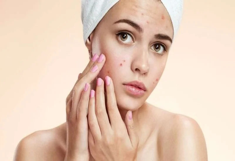 Bạn đã biết gì về hội chứng buồng trứng đa nang (PCOS)? 3 Bạn đã biết gì về hội chứng buồng trứng đa nang (PCOS)?