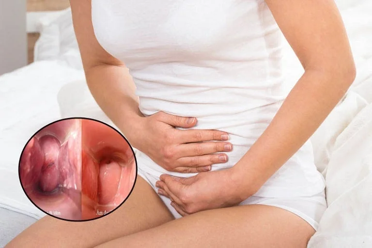 Đau rát vùng kín - Viêm nhiễm phụ khoa hay dấu hiệu bệnh lý nguy hiểm? 1 Đau rát vùng kín - Viêm nhiễm phụ khoa hay dấu hiệu bệnh lý nguy hiểm?