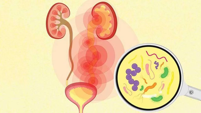 Đau rát vùng kín - Viêm nhiễm phụ khoa hay dấu hiệu bệnh lý nguy hiểm? 2 Đau rát vùng kín - Viêm nhiễm phụ khoa hay dấu hiệu bệnh lý nguy hiểm?