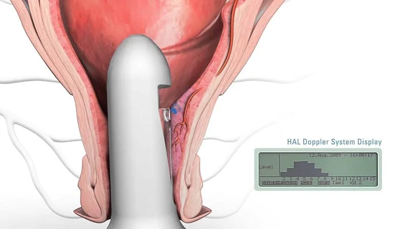 Siêu âm buồng trứng có cần phải nhịn ăn không? 4 Siêu âm buồng trứng có cần phải nhịn ăn không?