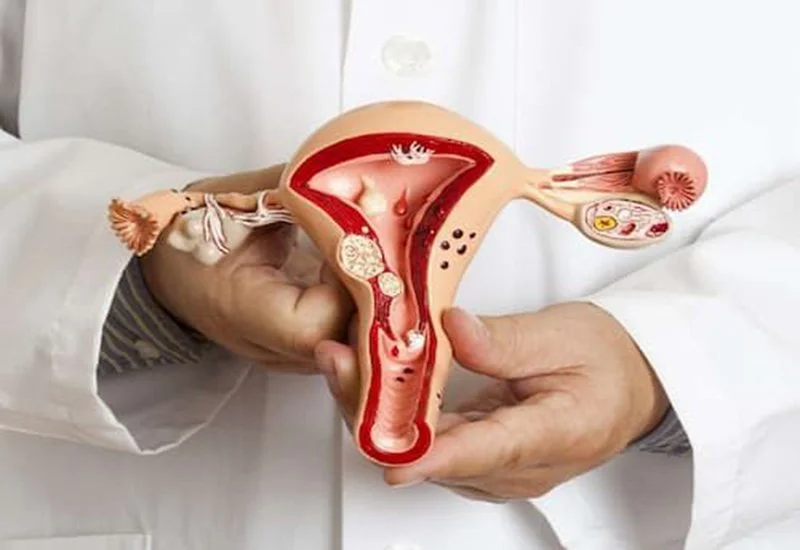 Siêu âm buồng trứng có đau không? Cần lưu ý gì khi siêu âm? 4 Siêu âm buồng trứng có đau không? Cần lưu ý gì trước và sau khi siêu âm?