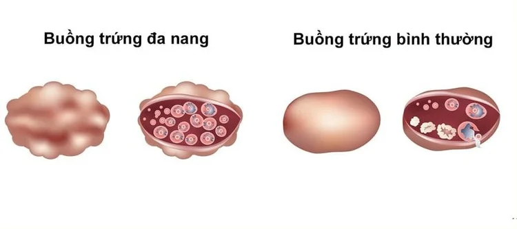 Bệnh Phụ Khoa - Mọi Thông Tin Bạn Cần Biết 1 benh-phu-khoa-moi-thong-tin-ban-can-biet