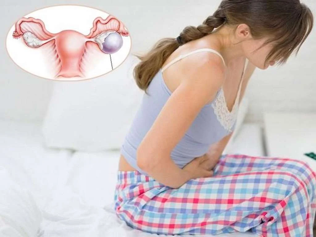 8 dấu hiệu buồng trứng đa nang bạn không nên bỏ qua 1 8 dấu hiệu buồng trứng đa nang bạn không nên bỏ qua