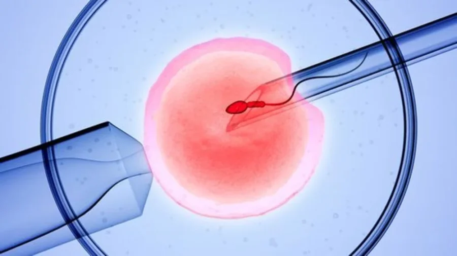 IVF là gì? Khi nào sử dụng biện pháp thụ tinh trong ống nghiệm? 1 Khi nào sử dụng biện pháp thụ tinh trong ống nghiệm