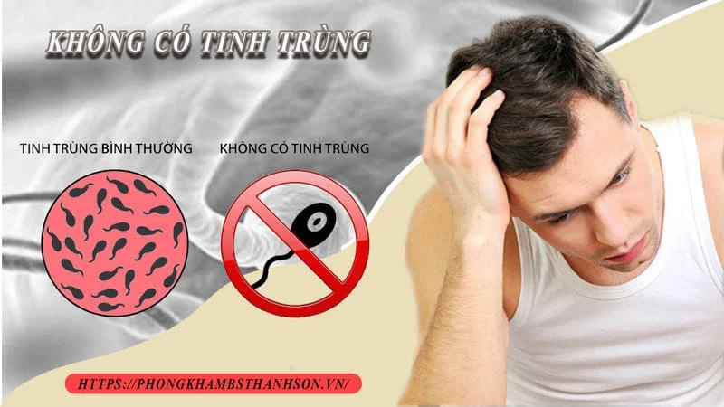 Vô sinh ở Nam giới - Chuẩn đoán và điều trị như thế nào? 2 Vô sinh ở Nam giới - Chuẩn đoán và điều trị như thế nào?
