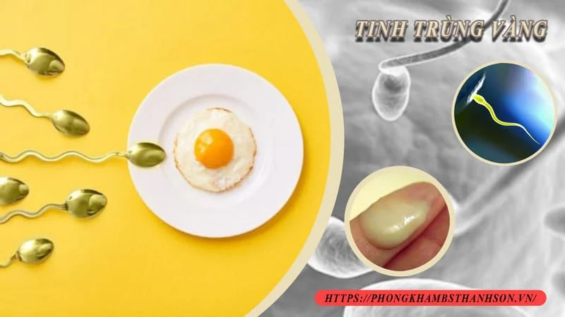 Vô sinh ở Nam giới - Chuẩn đoán và điều trị như thế nào? 3 Vô sinh ở Nam giới - Chuẩn đoán và điều trị như thế nào?