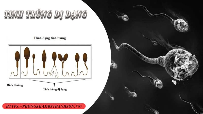 Vô sinh ở Nam giới - Chuẩn đoán và điều trị như thế nào? 4 Vô sinh ở Nam giới - Chuẩn đoán và điều trị như thế nào?