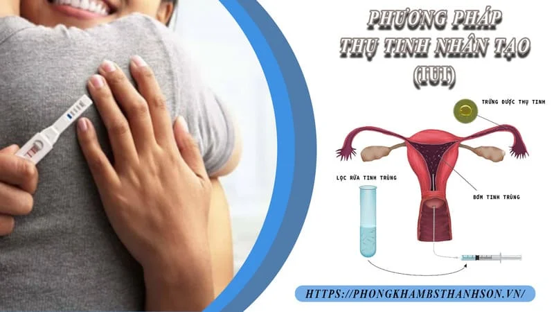 Vô sinh ở Nam giới - Chuẩn đoán và điều trị như thế nào? 7 Vô sinh ở Nam giới - Chuẩn đoán và điều trị như thế nào?