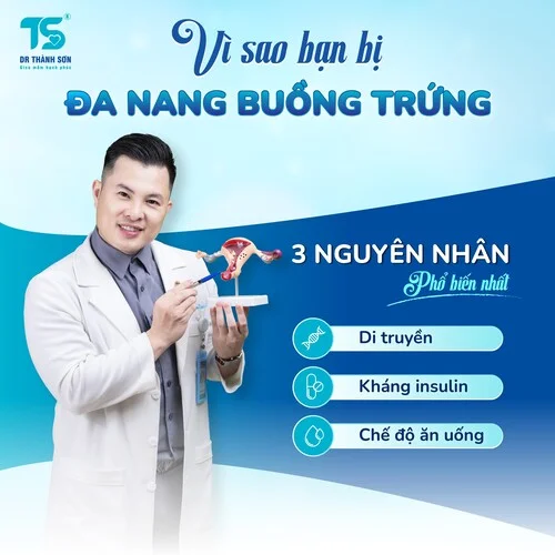 vì sao bạn bị đa nang buồng trứng