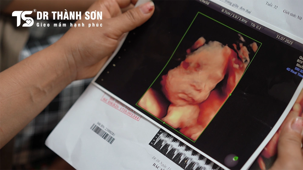 Nước mắt hạnh phúc sau 10 năm mong con: Câu chuyện của vợ chồng chị Ánh - anh Tuyên (Phổ Yên, Thái Nguyên) 4 Nước mắt hạnh phúc sau 10 năm mong con Câu chuyện của vợ chồng chị Ánh - anh Tuyên (Phổ Yên, Thái Nguyên)