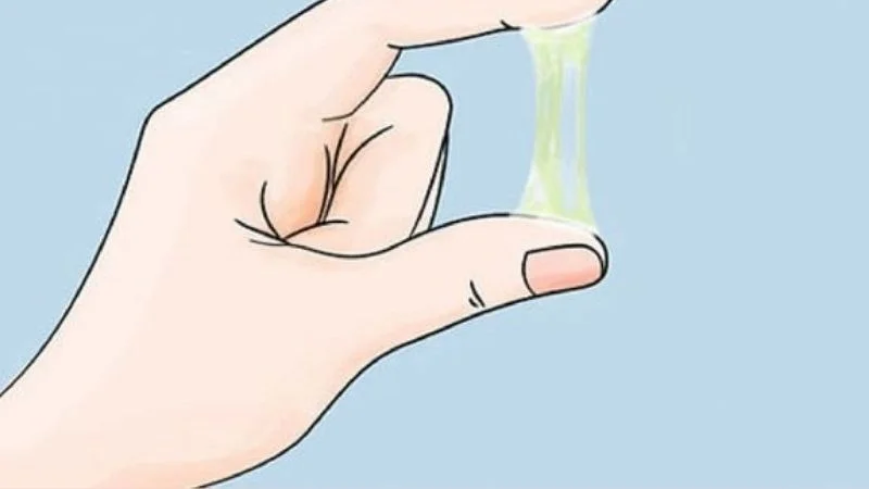Khí hư bất thường cảnh báo bệnh gì? Khi nào cần đi khám phụ khoa? 2 Khí hư bất thường cảnh báo bệnh gì? Khi nào cần đi khám phụ khoa?