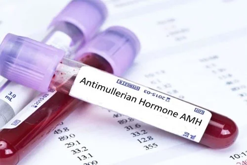AMH thấp, trứng kém: Liệu còn cơ hội làm mẹ sinh con tự nhiên? 2 AMH thấp, trứng kém: Liệu còn cơ hội làm mẹ và sinh con tự nhiên