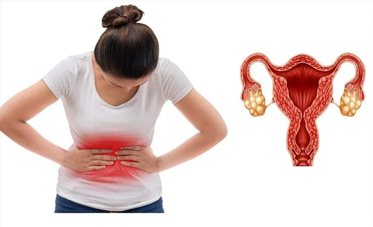 7+ bệnh phụ khoa thường gặp và nguy hiểm nhất hiện nay 6 7+ bệnh phụ khoa thường gặp và nguy hiểm nhất hiện nay