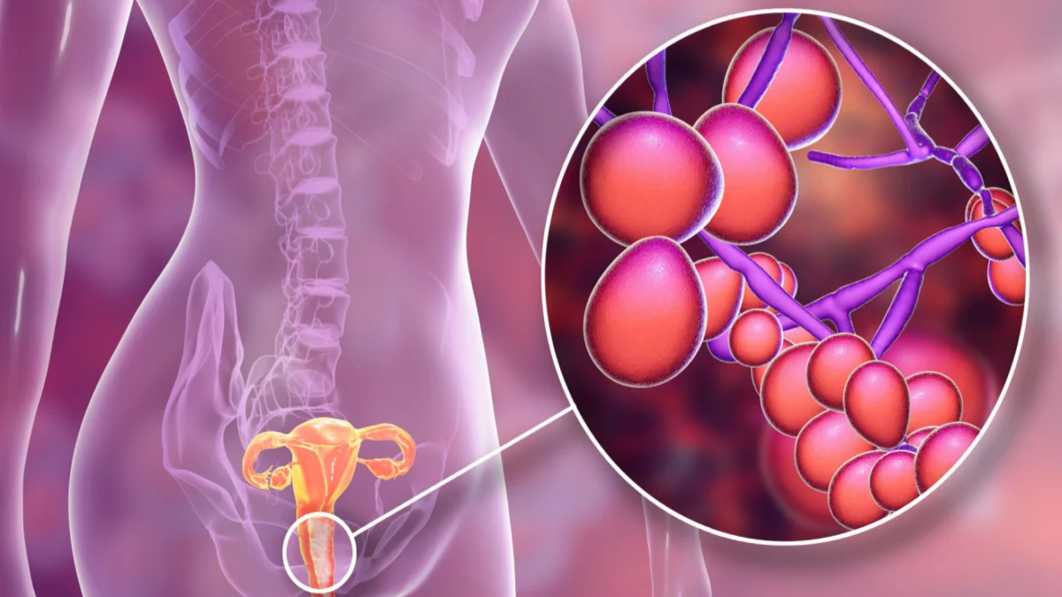 Nấm Candida là gì? Vì sao phụ nữ dễ bị nhiễm nấm Candida? 1 Nấm Candida là gì? Vì sao phụ nữ dễ bị nhiễm nấm Candida?