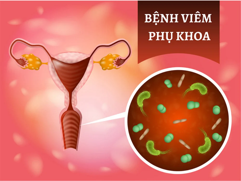 Review Top 5+ phòng khám phụ khoa Hà Nội uy tín, chất lượng 1 Review Top 5+ phòng khám phụ khoa Hà Nội uy tín, chất lượng