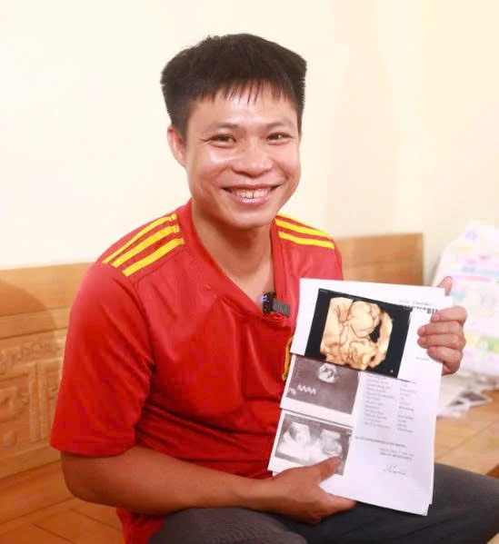 Anh Sỹ: Tinh trùng yếu không phải là dấu chấm hết cho giấc mơ làm cha! 3 Anh Sỹ: Tinh trùng yếu không phải là dấu chấm hết cho giấc mơ làm cha!