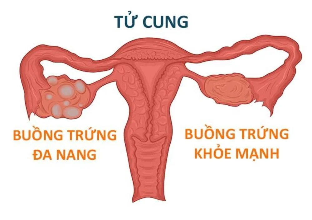 Khám tiền hôn nhân có cần cả hai đi cùng lúc không? 1 Khám tiền hôn nhân có cần cả hai đi cùng lúc không