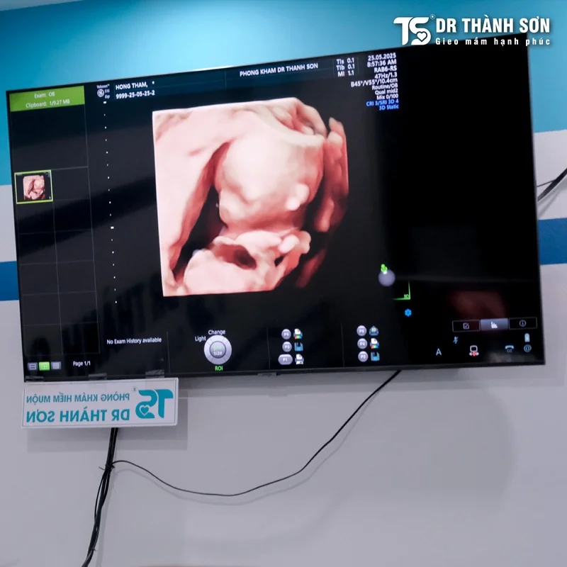 Phòng khám siêu âm thai 5D Long Biên nào được đánh giá tốt nhất? 1 Phòng khám siêu âm thai 5D Long Biên nào được đánh giá tốt nhất?