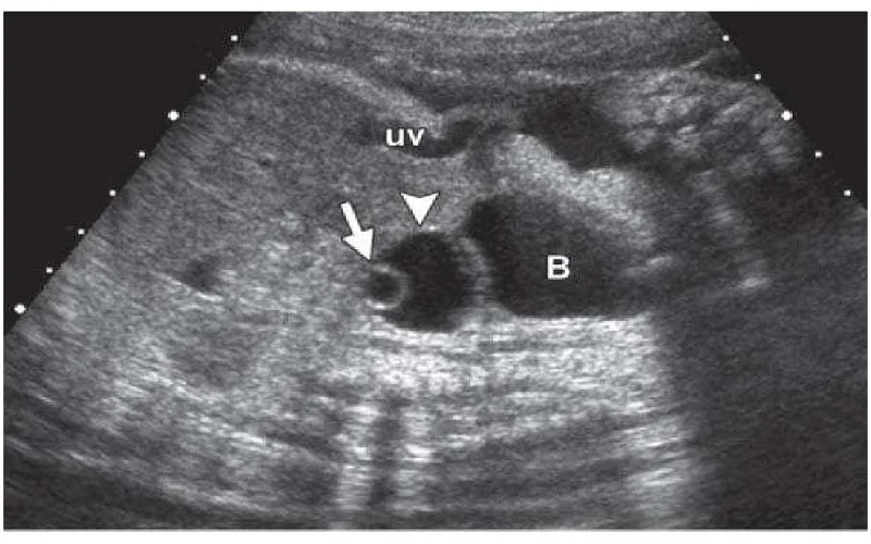 Canh trứng sau IVF – khác gì với canh trứng thông thường? 3 Canh trứng sau IVF – khác gì với canh trứng thông thường?