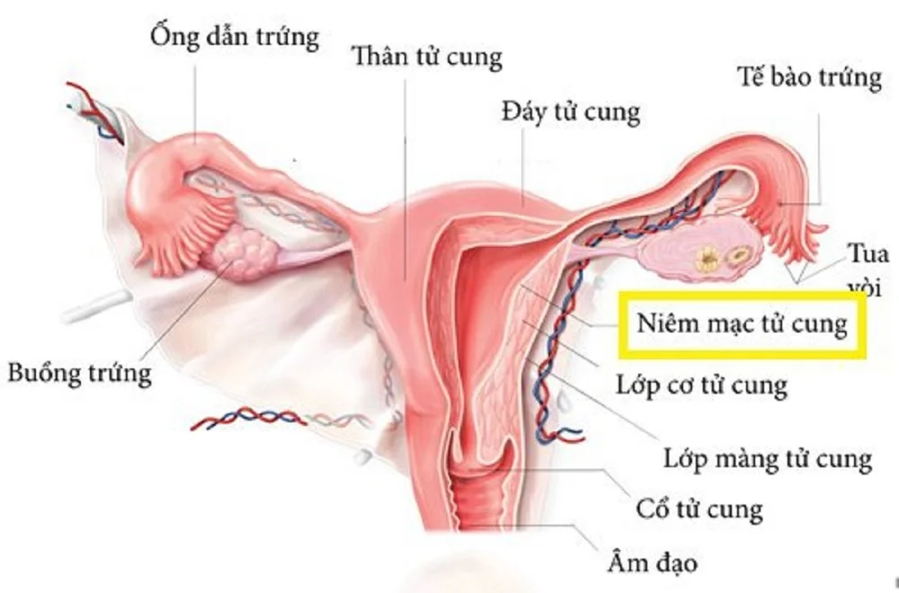 Niêm mạc tử cung là gì? Vì sao ảnh hưởng đến khả năng mang thai? 1 Niêm mạc tử cung là gì? Vì sao ảnh hưởng đến khả năng mang thai?