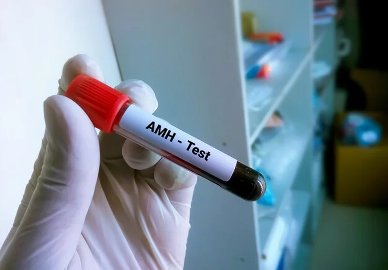 AMH là gì? AMH bao nhiêu được coi là thấp? 1 AMH là gì? AMH bao nhiêu được coi là thấp?