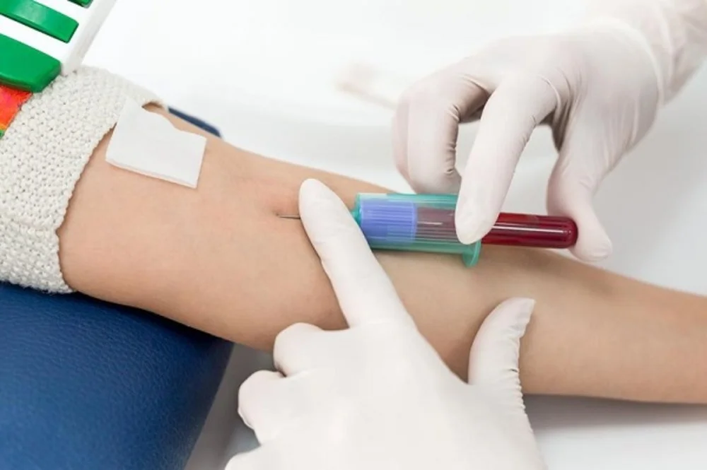Tất tần tật về Hormone FSH: Chỉ số 'vàng' đánh giá chất lượng trứng và khả năng sinh sản 5 Tất tần tật về Hormone FSH: Chỉ số 'vàng' đánh giá chất lượng trứng và khả năng sinh sản