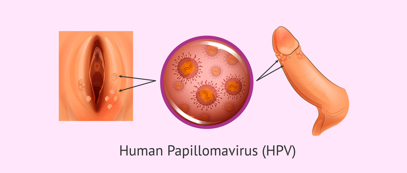 HPV là gì? Nguy cơ ở nam giới và mức độ nguy hiểm của type 16, 18 1 HPV là gì? Nguy cơ ở nam giới và mức độ nguy hiểm của type 16, 18