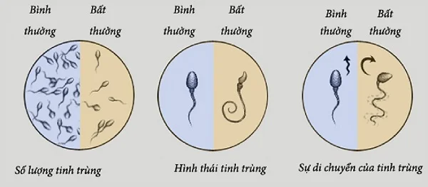 Xét nghiệm tinh dịch đồ ở đâu chính xác? Quy trình, chi phí & địa chỉ uy tín 2 Xét nghiệm tinh dịch đồ ở đâu chính xác? Quy trình, chi phí & địa chỉ uy tín