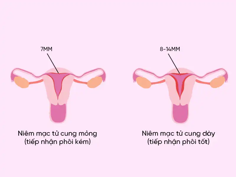 Tam giác thụ thai thành công – 3 yếu tố quyết định mang thai tự nhiên 4 Tam giác thụ thai thành công – 3 yếu tố quyết định mang thai tự nhiên